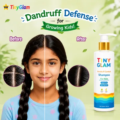 TinyGlam Dandruff Relief Shampoo 250 ml - Anti-Dandruff Shampoo for Kids & Teens (4–15 Years)